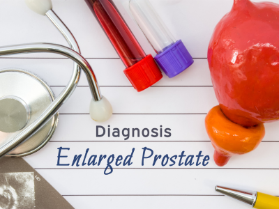 Enlarged-Prostate-Image