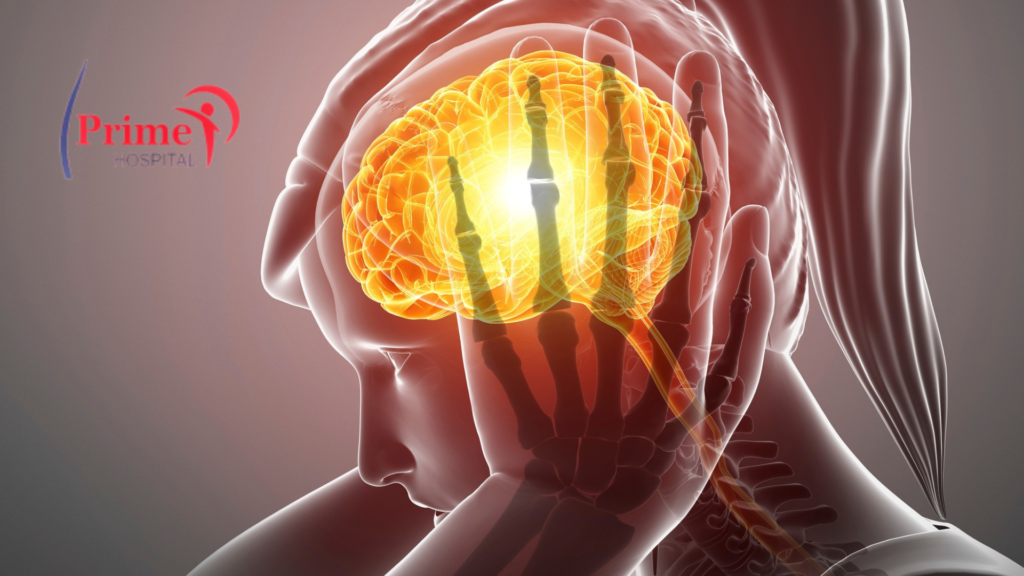 Best Neurology Treatment In Panipat