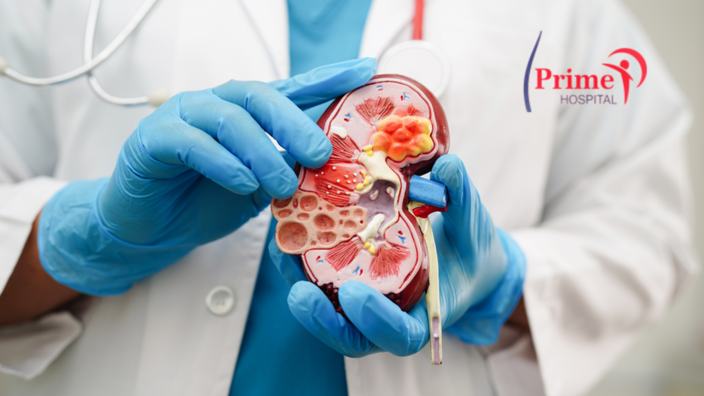 Best Urology Treatment in Panipat